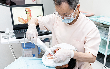 写真:口腔内スキャナー