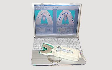 写真：咬合接触圧分布測定器