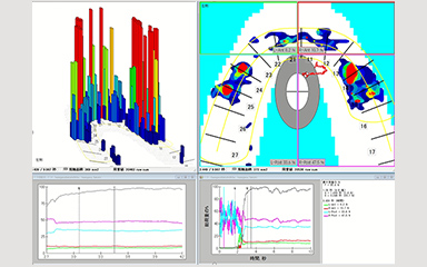 写真：咬合接触圧分布測定器