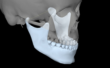 写真：顎運動機能検査