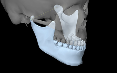 写真：顎運動機能検査