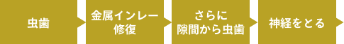 虫歯→金属インレー修復→さらに隙間から虫歯→神経をとる→